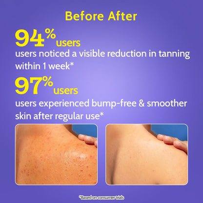 Daily Salicylic Acid Body Wash