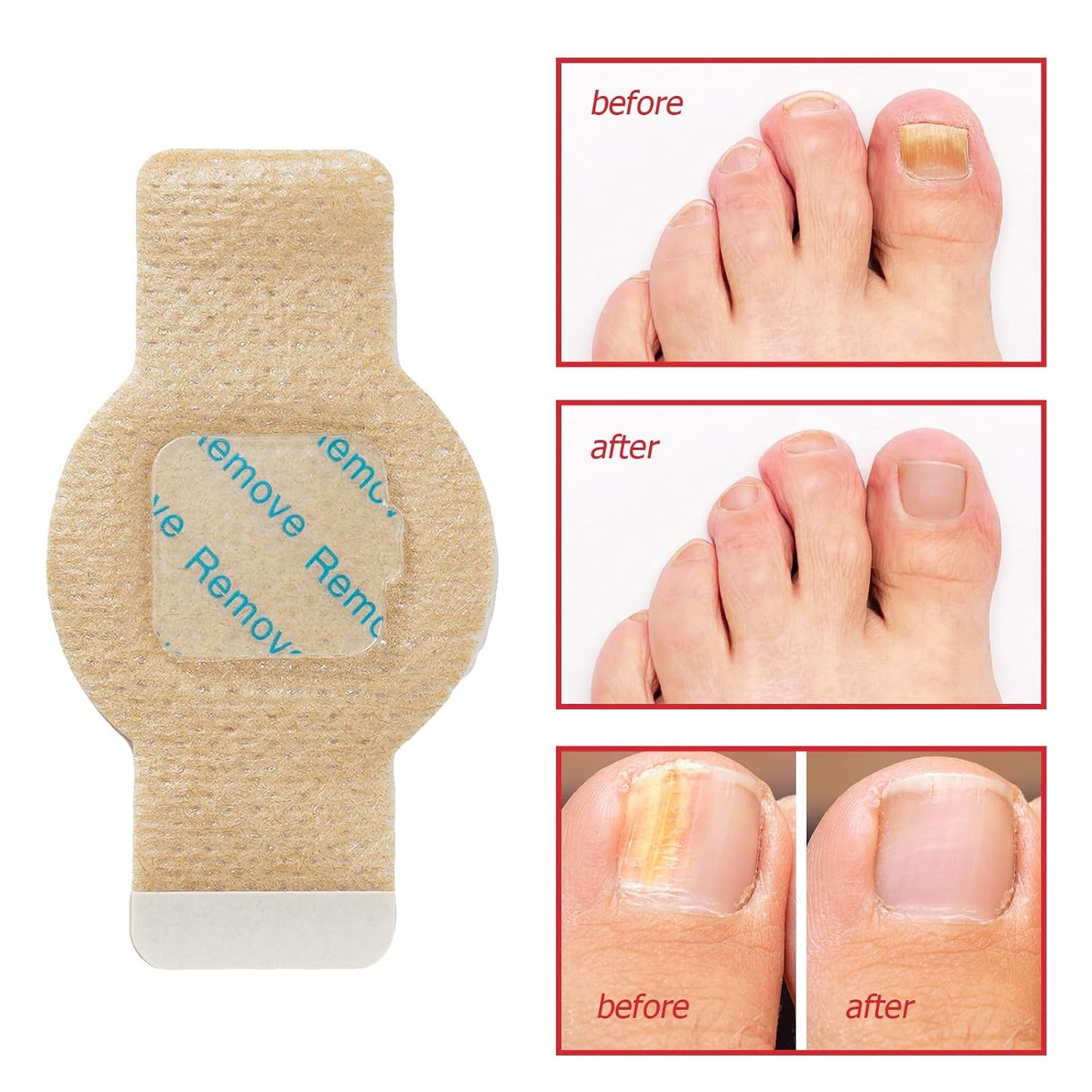 Overnight Nail Repair Patches