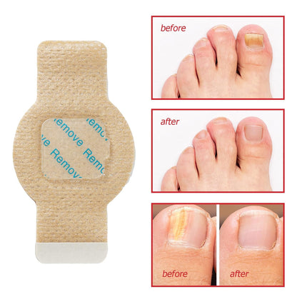 Overnight Nail Repair Patches