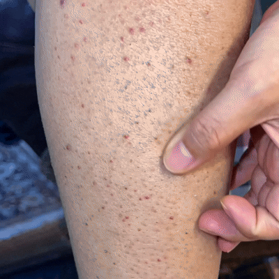 Close-up of rough, bumpy skin